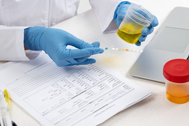 lab-doctor-performing-medical-exam-urine (4) https://laboratorioamare.com/wp-content/uploads/2023/05/lab-doctor-performing-medical-exam-urine-4-640x427.jpg